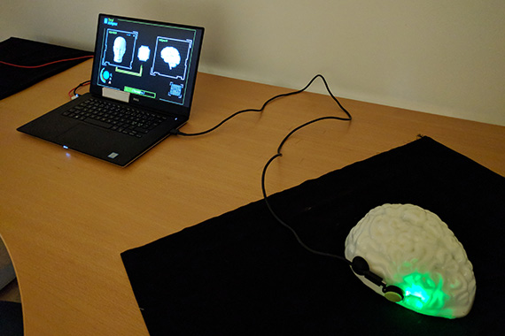 Datorsk&auml;rm och hj&auml;rna