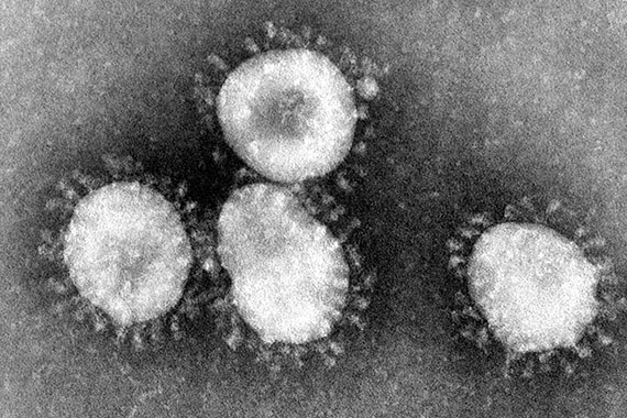 Bild tagnen av coronavirus i elektronmikroskop, d&auml;r vi ser hur virusets &rdquo;proteinspikar&rdquo; p&aring;minner om den ljuskrans vi ser runt solen vid solf&ouml;rm&ouml;rkelse och som kallas just korona, och d&auml;rav namnet p&aring; viruset. Foto: Wikimedia Commons, CDC/Dr. Fred Murphy