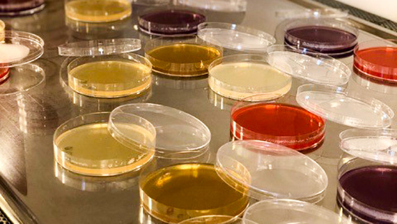 En av Lines bakterieodlingar.