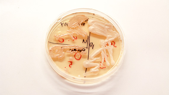 Forskarna b&ouml;rjar med att isolera j&auml;stsvamparna fr&aring;n naturen och odla upp dem i petrisk&aring;lar. Sedan testas svamparna f&ouml;r de egenskaper forskarna vill ha f&ouml;r att hitta en potentiell stam.
