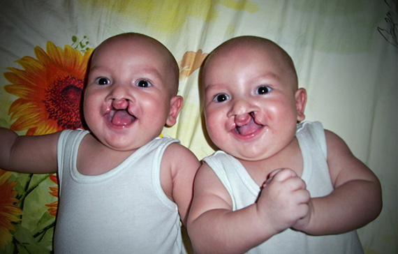 Fredagen den 13 december v&auml;lkomnar professor Martin Persson allm&auml;nheten till den kostnadsfria konferensen om LKG. Och p&aring; m&aring;ndag startar han ett nytt europeiskt projekt f&ouml;r att st&ouml;dja m&ouml;drar med f&ouml;rlossningsdepression.