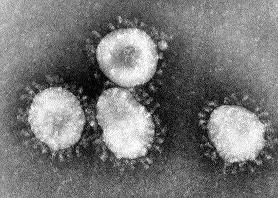 Bilder som denna, tagna av coronavirus i elektronmikroskop, p&aring;minner om den ljuskrans vi ser runt solen vid solf&ouml;rm&ouml;rkelse och som kallas just korona, och d&auml;rav namnet p&aring; viruset. Foto: Wikimedia Commons, CDC/Dr. Fred Murphy