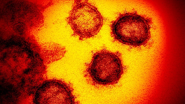 En mikroskopisk bild av coronavirus SARS-CoV-2.